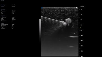 Vevo MD UHF 48 - Phantom with needle insertion