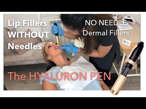 lip-filler-without-needles-|-no-needle-dermal-fillers-|-with-the-hyaluron-pen