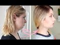 How to get rid of a double chin in South Korea / Acculift / GNG Hospital / Accusculpt / Anti-aging