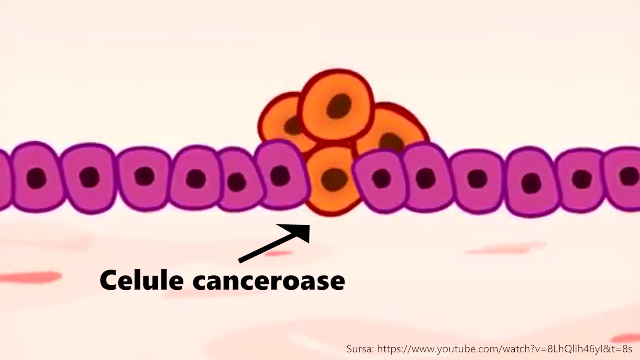 Cum functioneaza IMUNOTERAPIA ONCOLOGICA