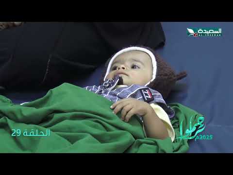 الطفل أركان يعاني من سؤ التغذية ويحتاج للمساعدة بالشفاء العاجل، تراحموا