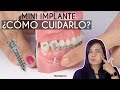¿Cómo limpiar los Mini Implantes de ortodoncia? 🔩 ¿Qué debo usar? - Odontología Láser.