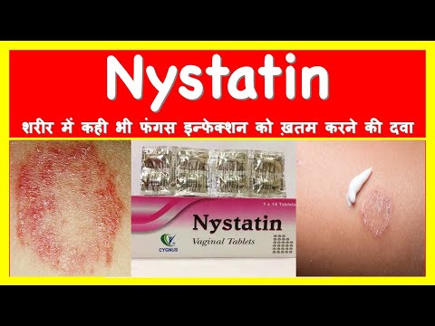 वीडियो: Nystatin क्रीम का उपयोग कैसे करें: 13 चरण (चित्रों के साथ)