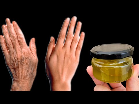 Video: Welches Öl ist gut für Tränensäcke?