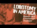 Lobotomy in america walter freeman and the historys most controversial treatment