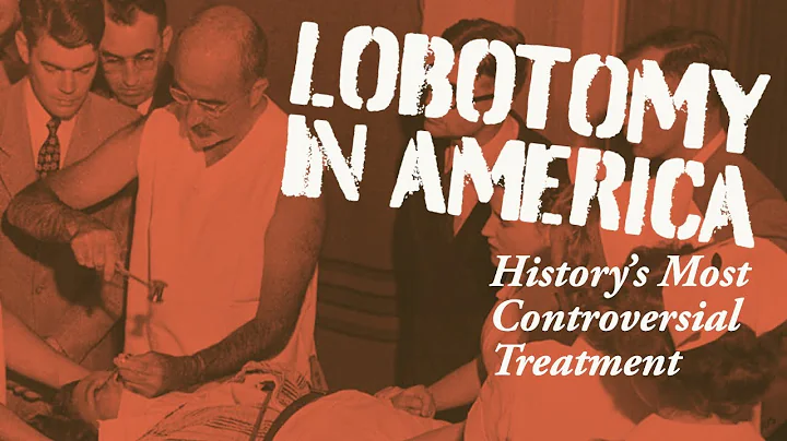 Lobotomy in America: Walter Freeman and the Histor...
