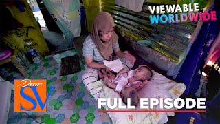 Kilalanin ang isang batang ina na si Hashima,na may anak na conjoined twins (Full episode) | Dear SV