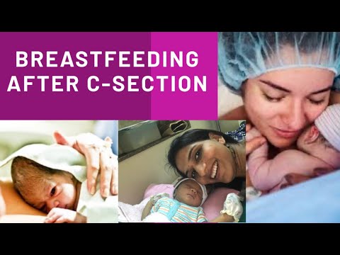 BREASTFEEDING POSITIONS AFTER C-SECTION (CESAREAN)|day 1-3 cesarean delivery breastfeeding positions