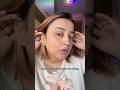 Acne Marks Remove Karne Ka Secret😳✨ | Pilgrim 10% Niacinamide Serum Review #shorts #trending #viral