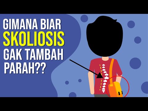 Gimana biar Skoliosis gak tambah Parah??