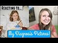 Reacting to My Diabetes Diagnosis Photos!