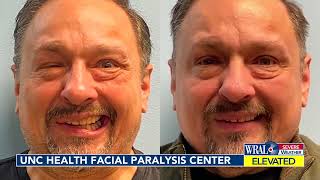 Facial Paralysis Center at UNC Health Gives Back Patients' Smiles (WRAL) 3/23/22.  Dr. Matt Miller.