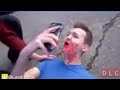 lankybox Adam gets hit by a car! (lankybox Adam addicted to Snapchat)