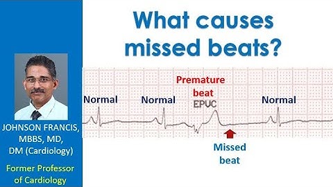 What causes missed beats?
