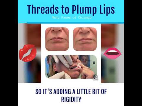 Video thumbnail: Thread lift to Plump Lips Chicago | Dr. Benjamin Caughlin - Facial Plastic Surgeon — ManyFaces by Benjamin Caughlin, MD, FACS 