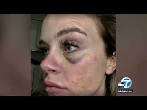 Ex deputy speaks out after jury finds her attacker not guilty