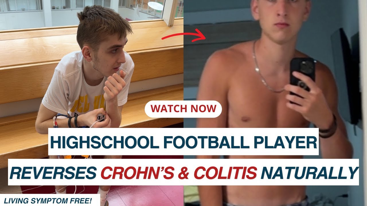 Из больницы к новой жизни: история Уилла о болезни Крона и колите @crohnscolitislifestyle