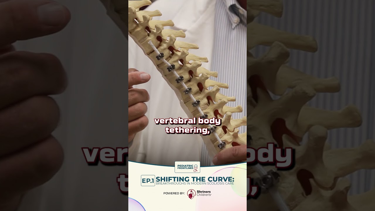 Pediatric Frontlines: Vertebral Body Tethering in Scoliosis Treatment