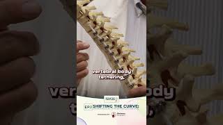 Pediatric Frontlines: Vertebral Body Tethering in Scoliosis Treatment