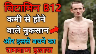 विटामिन B12 की कमी से होने वाले नुकसान और इसका इलाज|B12की कमी से होने वाले रोगshortsin_life_mature