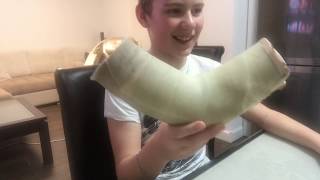 Снял гипс полностью - ура 😃 Короче говоря я сломал руку / Как снять французский гипс ? Снял гипс полностью - ура 😃 Короче говоря я сломал руку / Как снять французский гипс ?