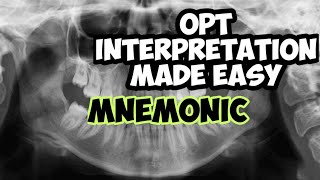 Dental Panoramic radiograph | OPT | DPT interpreting dental x-rays screenshot 3