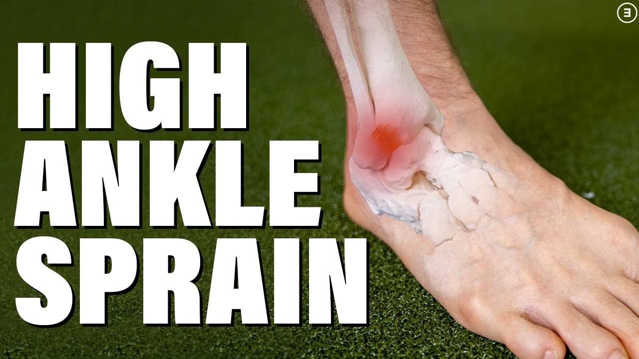 Ankle Sprain and Strain Signs and Symptoms