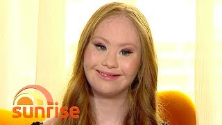 The world’s first professional model with Down syndrome | Sunrise