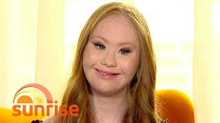 Famous The world’s first professional model with Down syndrome | Sunrise Profile