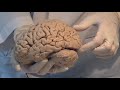 تشريح الدماغ البشري مترجم