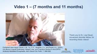 Neuroimmunology Nuggets: Autoimmune Encephalitis