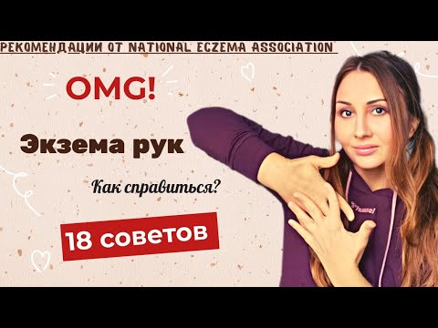 Как лечить ЭКЗЕМУ НА РУКАХ?18 советов. Атопический дерматит на руках: Причины, Симптомы,Профилактика