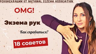 ❓Как лечить ЭКЗЕМУ НА РУКАХ? Атопический дерматит на руках. Почему сохнут и трескаются руки?