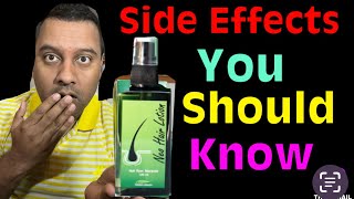 The Shocking Neo Hair Lotion Side Effects You Should Know Before Using It