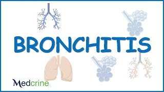 Acute Bronchitis : causes,clinical features,diagnosis and treatment