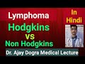 Lymphoma || Hodgkins vs Non Hodgkins