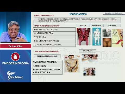 1  PI24   ENDOCRINOLOGA   Hipogonadismo Hipogonadismo