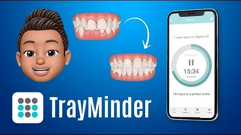 Invisalign: TrayMinder (App)