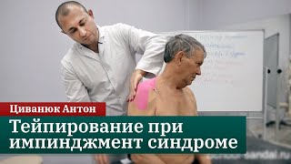 Тейпирование при боли в суставах. Импинджмент синдром. Прикладная кинезиология. Циванюк Антон