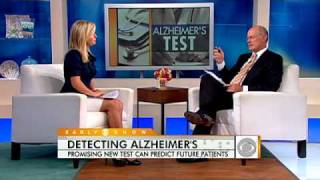 New Test May Predict Alzheimer's