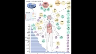 MECFS and Long Covid--Infection Associated Chronic Illness