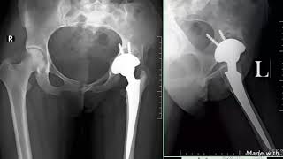 Orthopaedic X-Rays Collection By Zam Zam Digital X-Ray Mianwali
