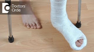 When can one start walking after Leg Fracture? - Kiran Sundara Murthy screenshot 3