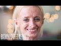 The Woman Who Ages Too Fast | BORN DIFFERENT