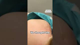 Muscle Twitch! 😳 Dry Needling Trigger Point Demo | Towson, MD Chiropractor #Shorts