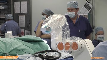 SEEG procedure with neuromate