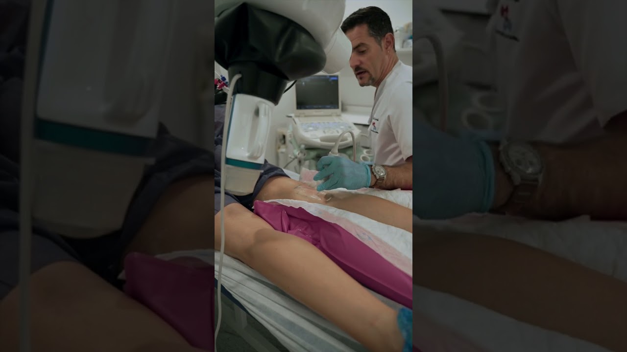 ECHOTERAPIA SONOVEIN - IVEI CLÍNICA VASCULAR MARBELLA