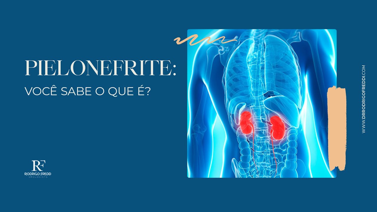 Pielonefrite: você sabe o que é?| Dr. Rodrigo Freddi CRM 129415 - YouTube