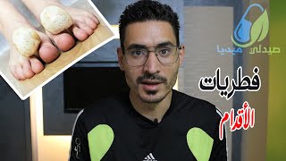 فطريات القدمين , طرق الوقاية والعلاج