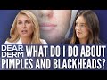 What do I do about pimples and blackheads? Emily DiDonato & Dr. Julie Russak | Model Skincare